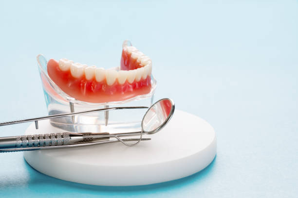 Best Dental Implants  in USA